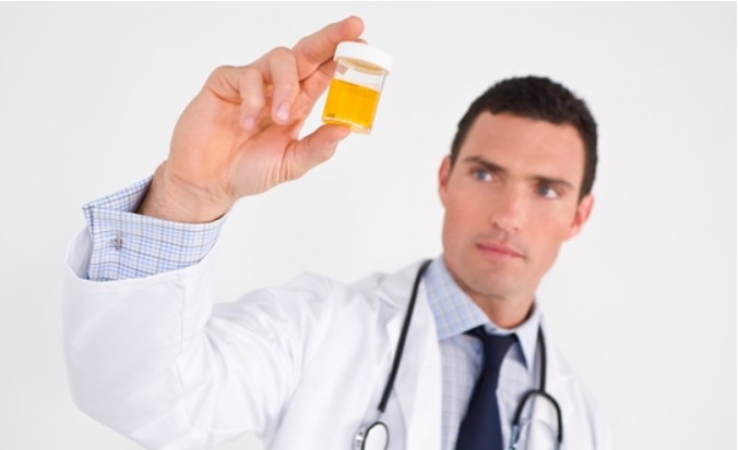 소변색깔이-적갈색-이라면