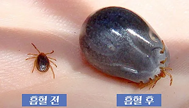 진드기 물린 증상 자국 퇴치법 치료법 완벽 정리_6