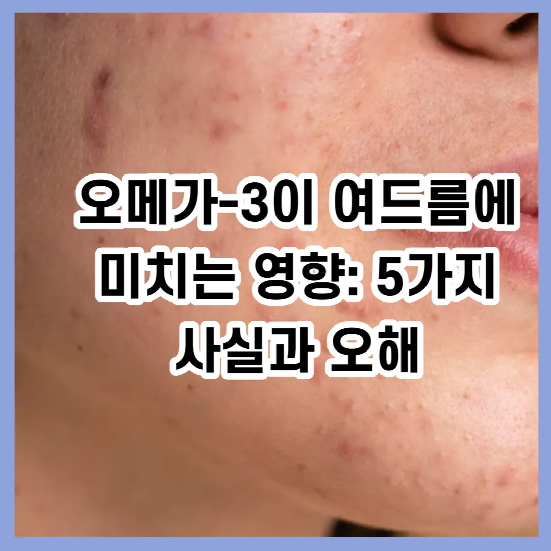 오메가-3이 여드름에 미치는 영향: 5가지 사실과 오해