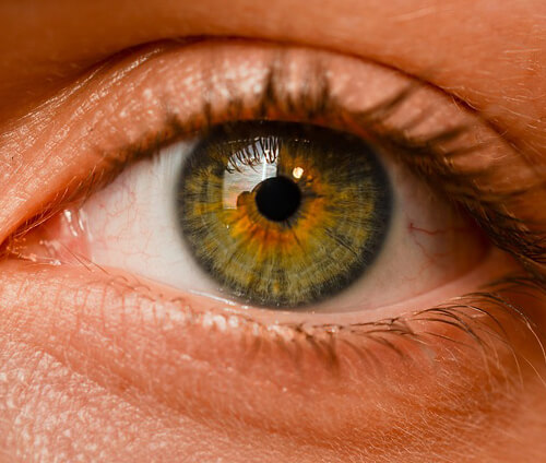 비문증-망막박리