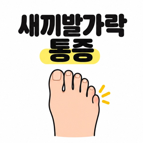 새끼발가락 통증 제목 아래 발 바깥쪽 작은 발가락 주변을 노란색으로 표시한 발 삽화