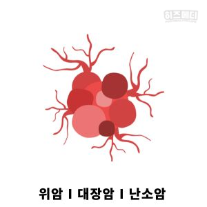 배에 가스가 자주 차는 이유