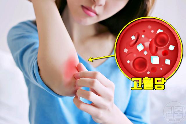 혈당이 높으면 나타나는 증상 건조한 피부