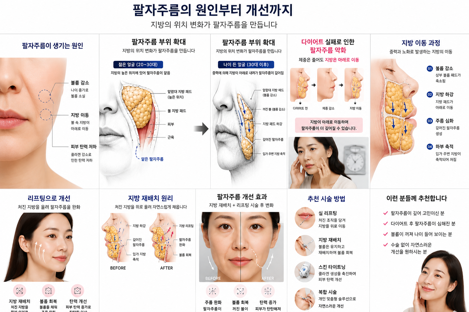 팔자주름 부위 확대