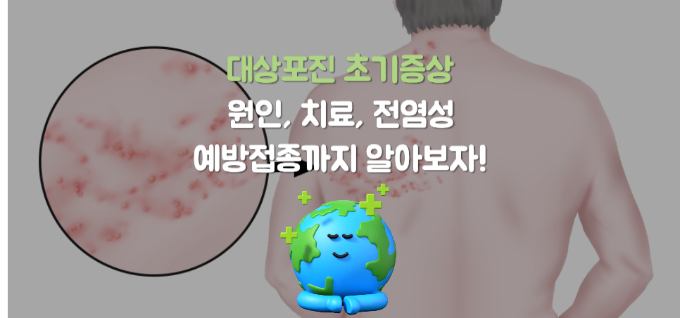 대상포진 초기증상 6가지?, 원인, 치료, 전염성 그리고 예방접종까지 알아보자!