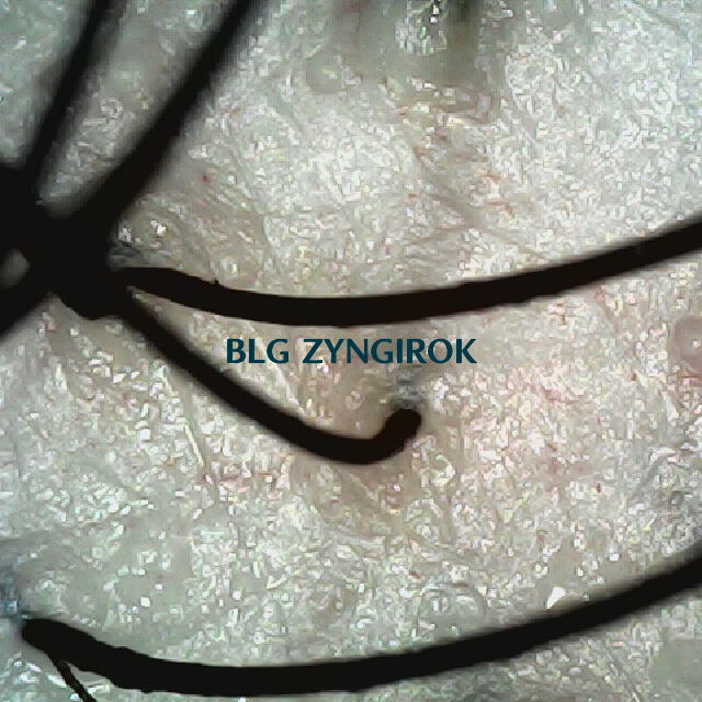 탈모 극복 프로젝트 - 뒷머리 두피 모습이다.