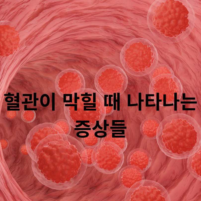 혈관이 막히는 이유? 당신이 몰랐던 진짜 원인들!