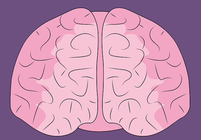 급성 경막하출혈