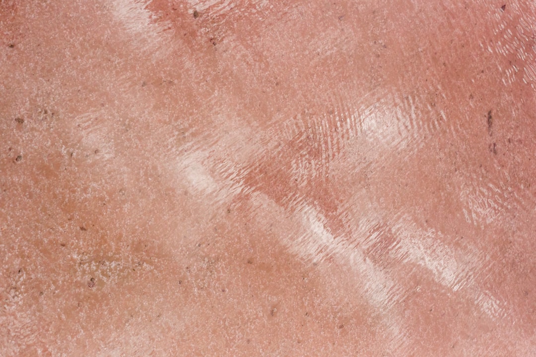Pores