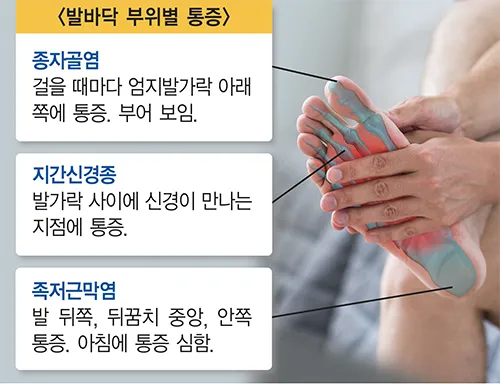 발바닥 가려움증 증상 4가지 이유 원인 치료법_6