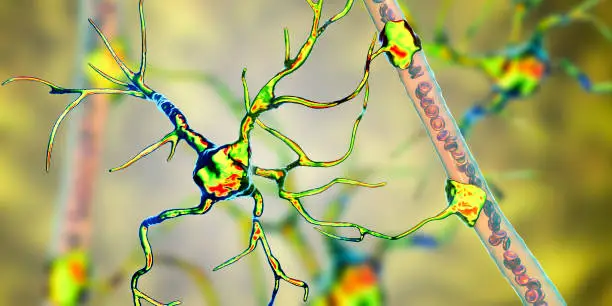 다발성 경화증 식생활 가이드와 증상, 원인! 오늘은 다발성경화증 환자분들을 위한 식생활 가이드에 대해 이야기해볼까 해요. 우리 몸을 건강하게 지키는 데 있어 식생활이 얼마나 중요한지는 이미 잘 알고 있죠? 특히 다발성경화증과 같은 질환을 가진 친구들에게는 더욱더 신경 써야 할 부분이랍니다. 그럼, 어떻게 하면 좋을지 함께 알아보아요!