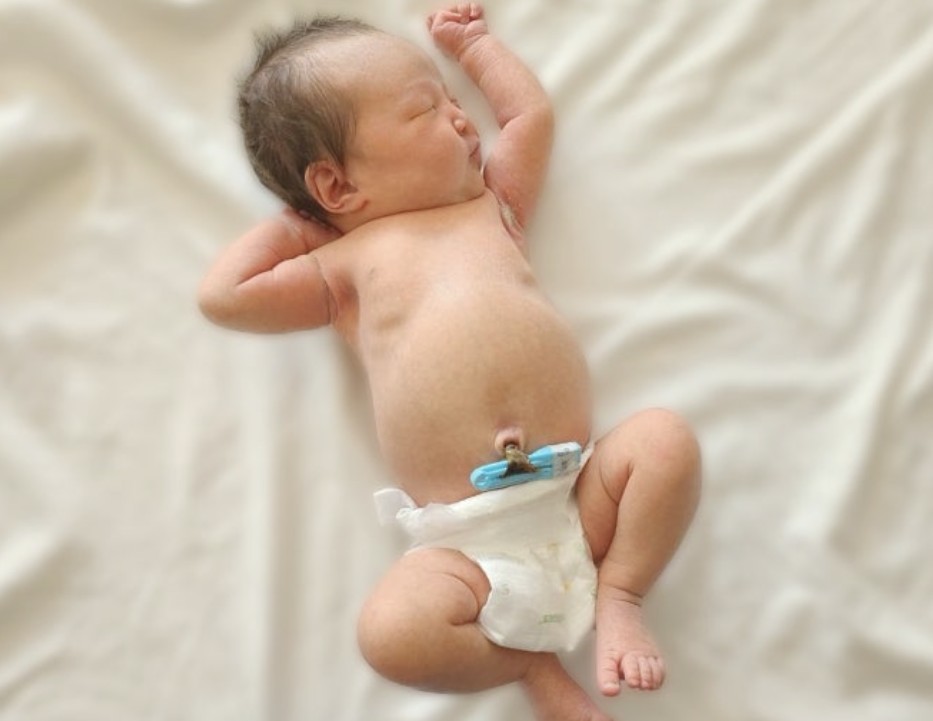 신생아 배꼽 관리법