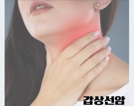 한-여성이-갑상선암으로-목을-만지며-아파하는-사진