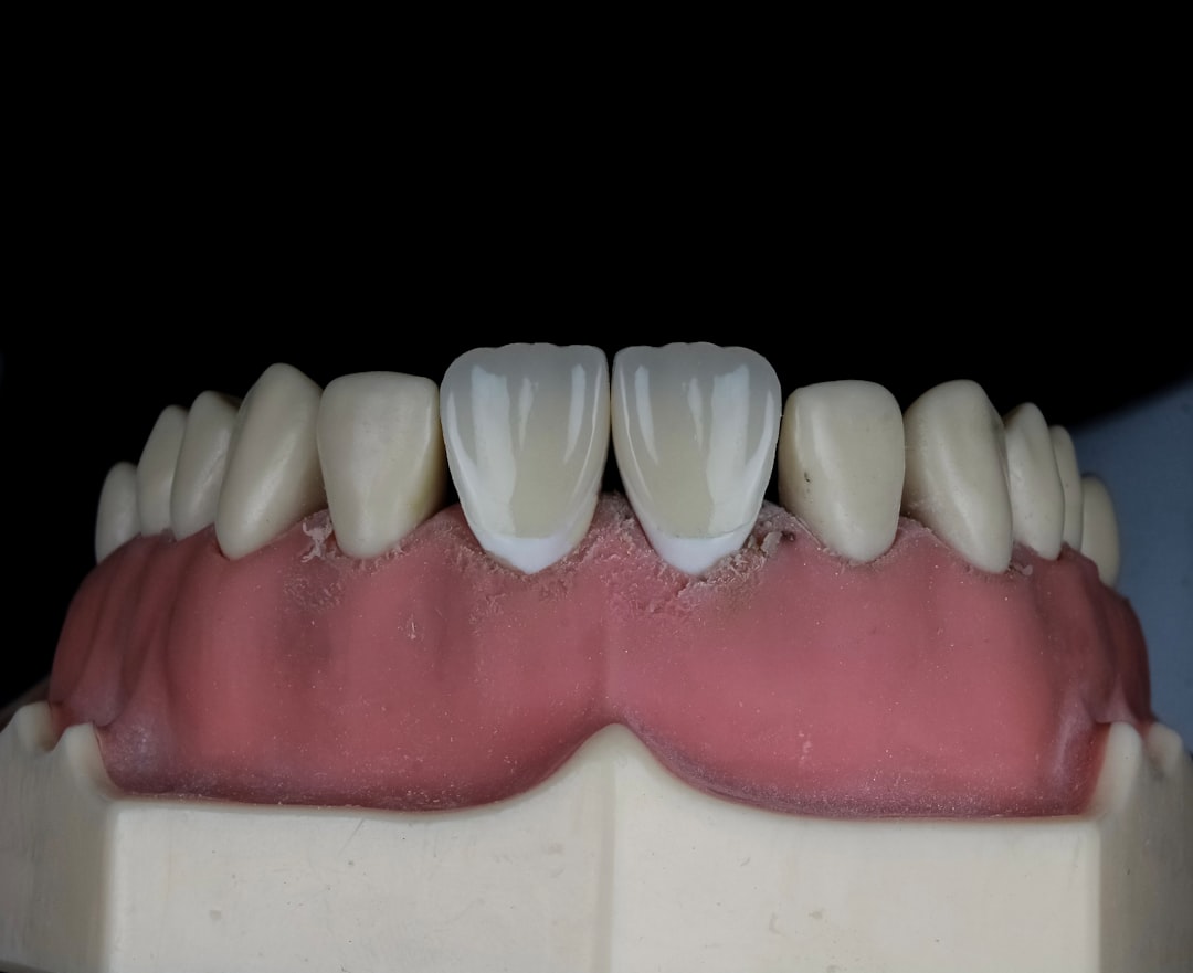 Periodontitis