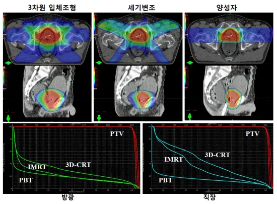 전립선암 초기증상
