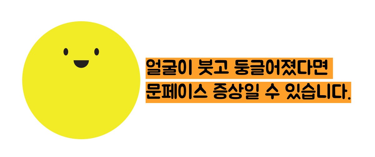 쿠싱증후군 증상