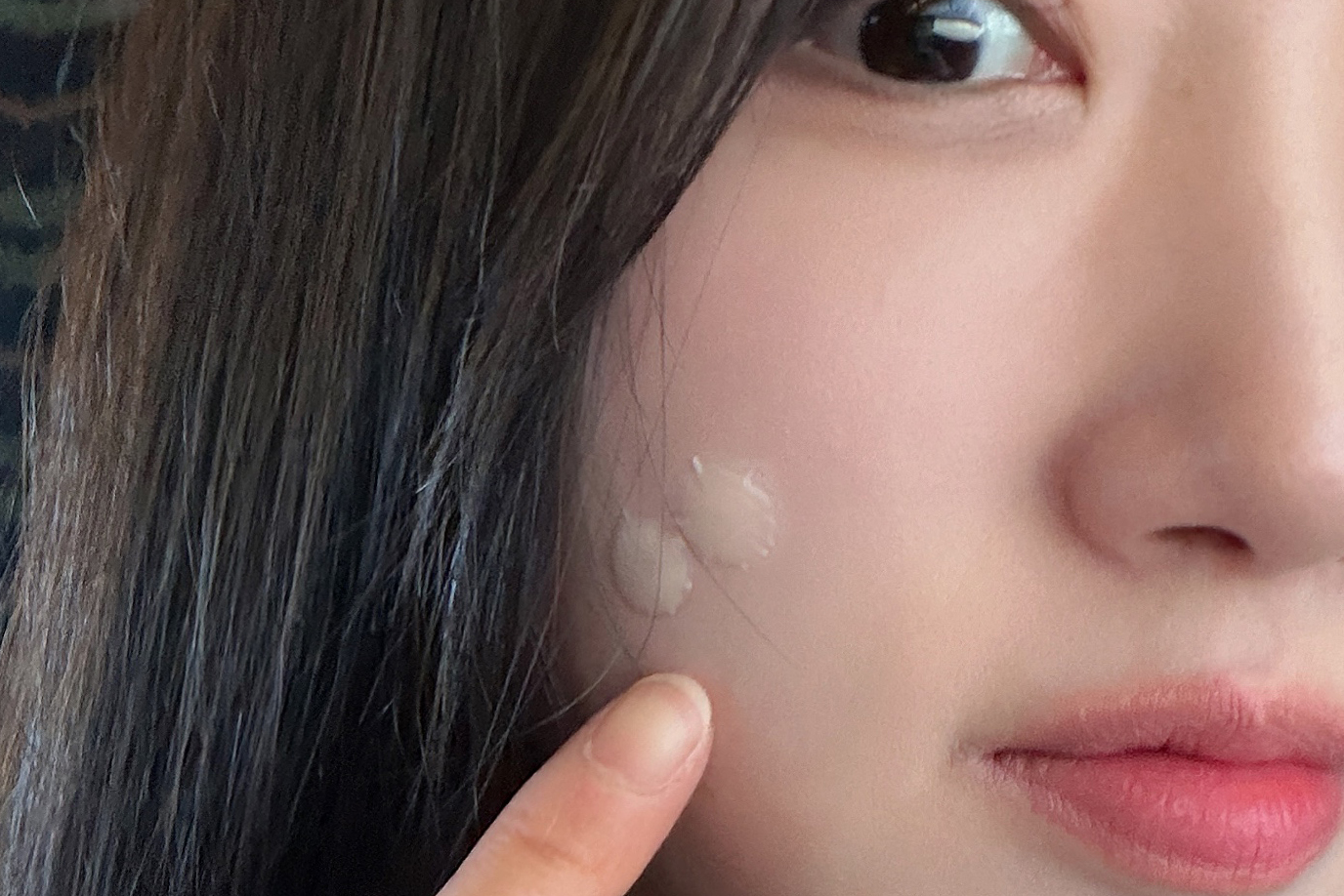 피부과 점제거 시술, 점 뺀 후 피부 이미지