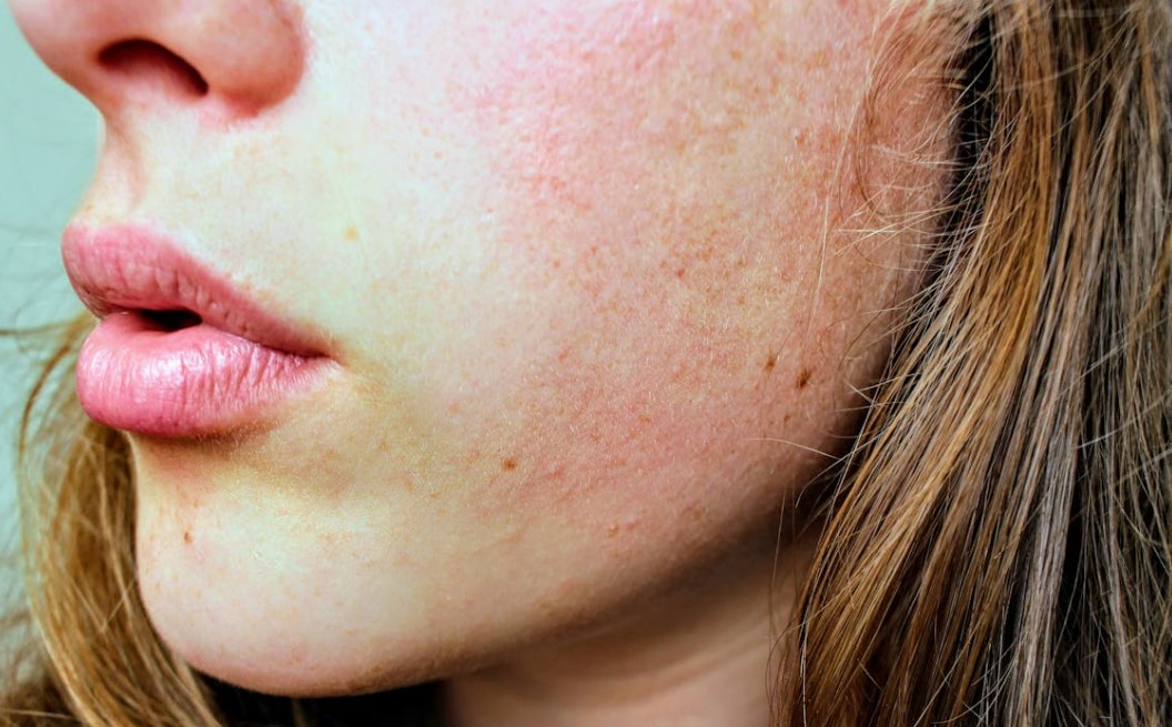 피부장벽 무너지면 생기는 문제와 회복하는 법, 완벽 정리