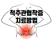 이 이미지를 클릭하시면 척추관협착증 치료 방법 및 운동법에 관한 포스팅으로 이동 됩니다.