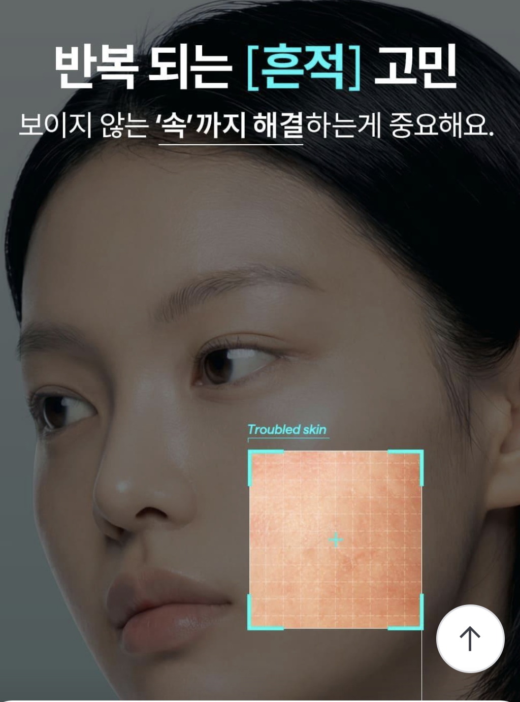 마데카소사이드 크림