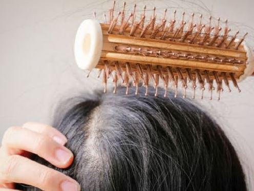 미녹시딜-부작용