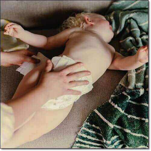 기저기발진에 좋은 바셀린