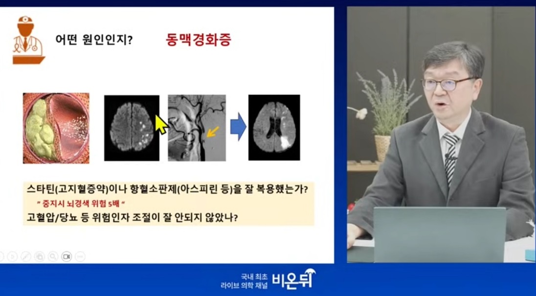 EBS-명의-경동맥-방오영-교수