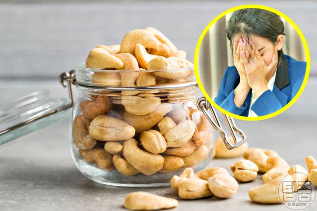 빈혈 좋은음식 캐슈넛 천연철분제 갱년기빈혈 노인빈혈