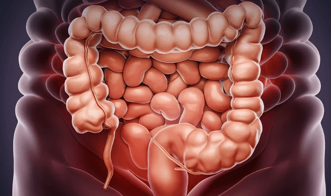 장에 좋은 음식 추천과 먹는 법 총정리