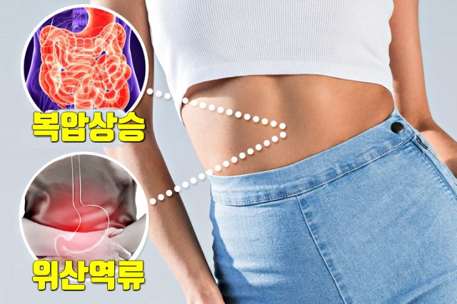 역류성 식도염 원인 복압 속옷, 건강 팁줌 매일꿀정보