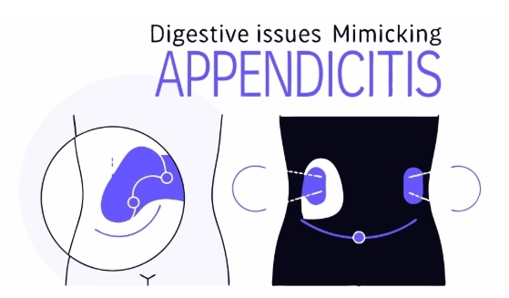 맹장염 증상과 비슷한 다른 질환
