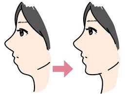 히알루론산 효능 10가지 및 부작용