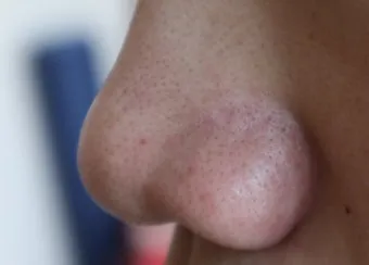 남자 얼굴 피지 제거 화장품 꿀템_15