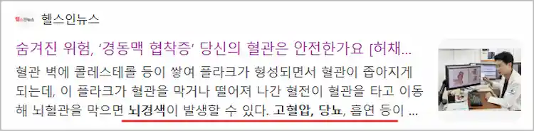 뇌경색 원인 기사 이미지