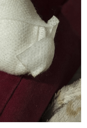 손가락마디통증