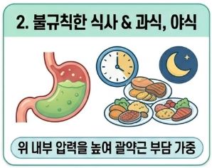 역류성 식도염