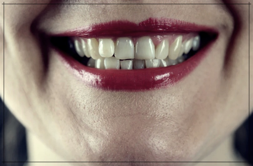 혀 따가움으로 생기는 질병 3가지.