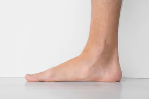 발바닥통증의 원인