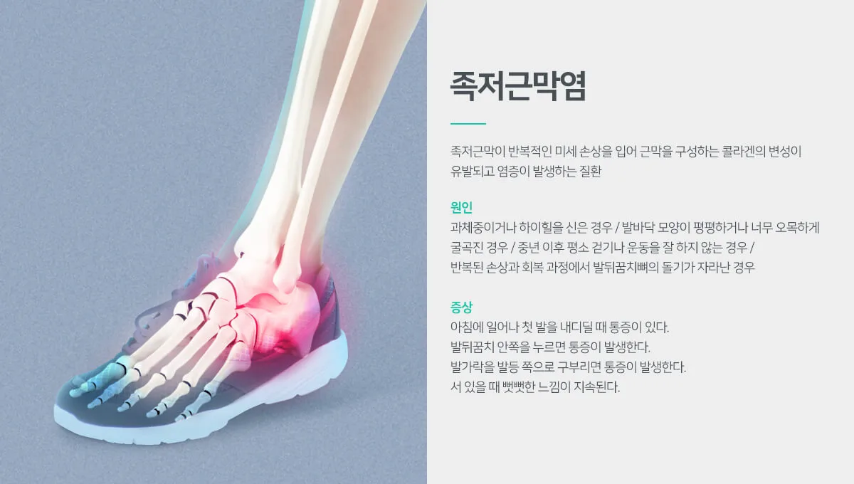 출처-족저근막염 최마취통증의학과 의원