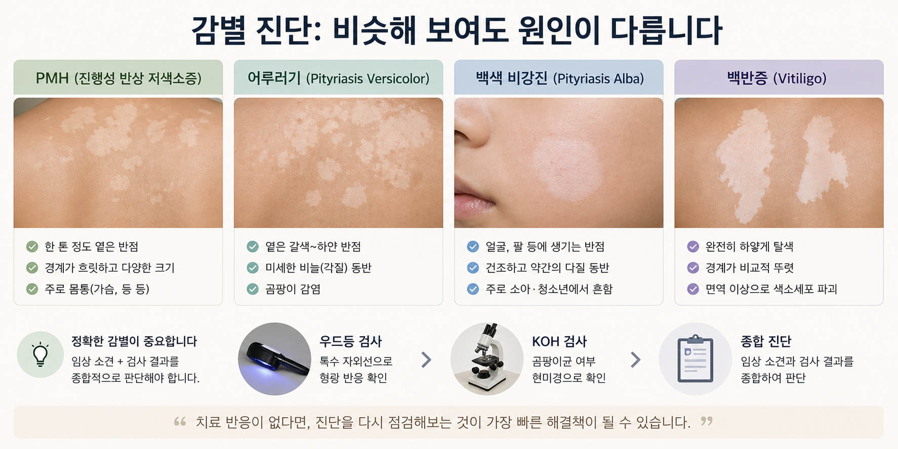 진행성 반상 저색소증 (오진 경험, 광선치료, 감별 진단)