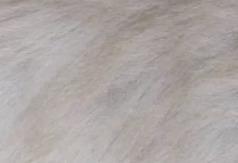 백반증 초기증상 17