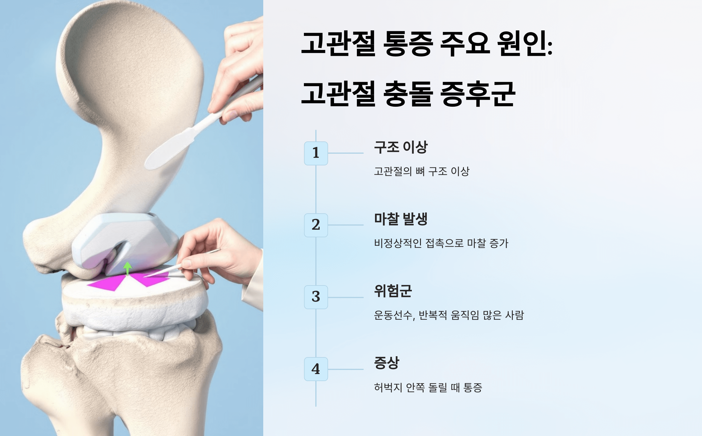 고관절 사진입니다.