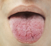 우리가 잘 모르는 자가면역질환 3탄-배체트병, 쇼그렌증후군