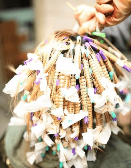 모발이식 3000모 비용