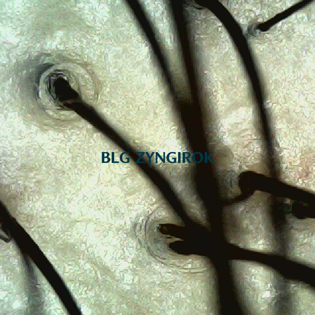 탈모 극복 프로젝트 - 정수리 두피 모습이다.