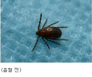 살인진드기 물린자국