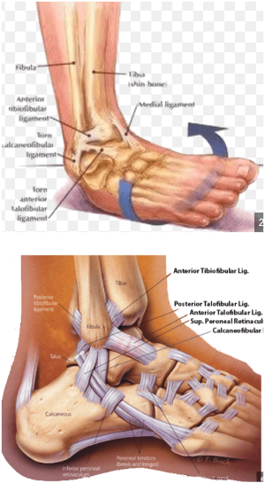 발목인대와-발목이-꺽이는-모습