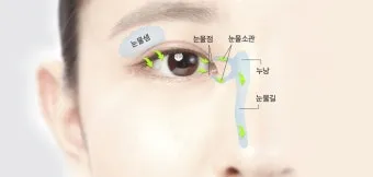 눈물샘 뚫는 수술 간단한가요에 대한 수술정보_53
