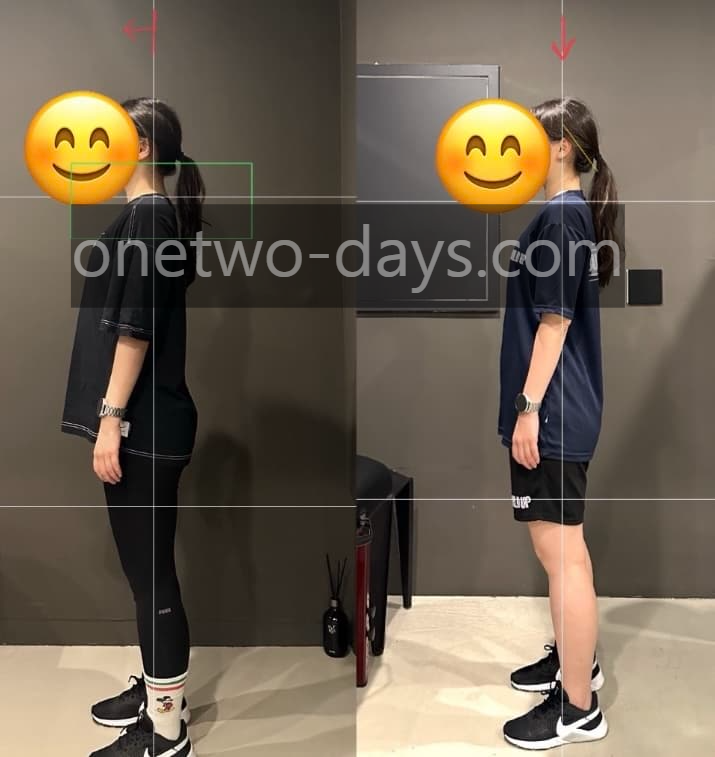 [재활 케이스] 라운드 숄더 교정 전후 측면 사진 - 10년 차 트레이너 분석