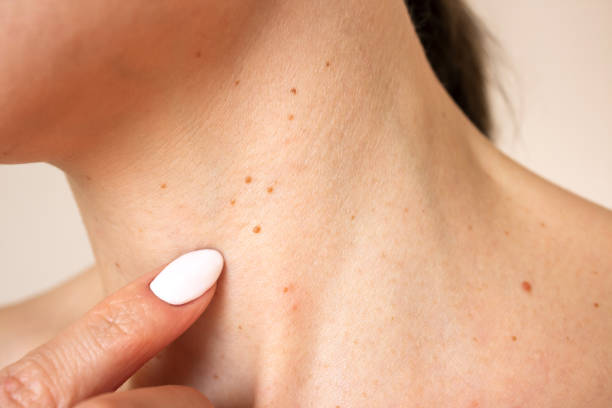 호르몬 변화의 영향